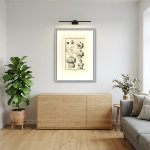 Breast Conditions and Treatment, Diderot Chirurgie Plate XXVIII, circa 1772, shown framed in a room