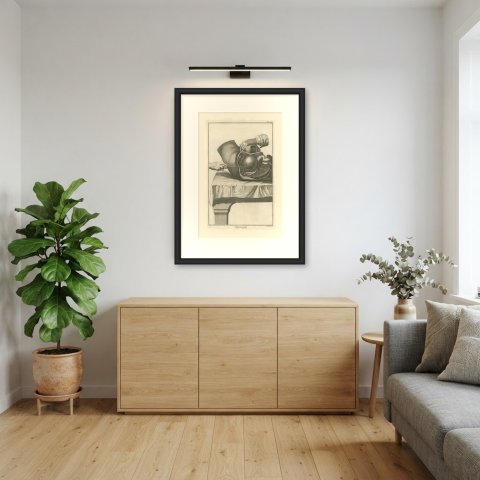 Opened Abdomen and Bladder Dissection, Diderot Chirurgie Plate XIV, circa 1772, shown framed in a room