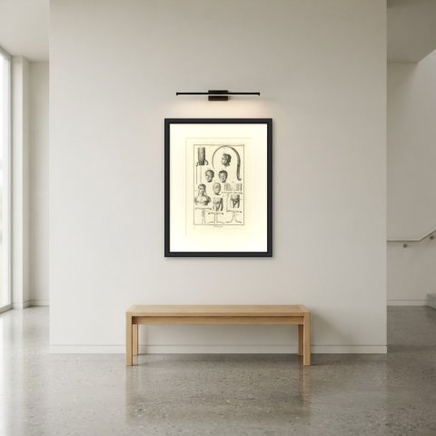 Head, Face and Body Bandages, Diderot Chirurgie Plate XXVII, circa 1772, shown framed in a room